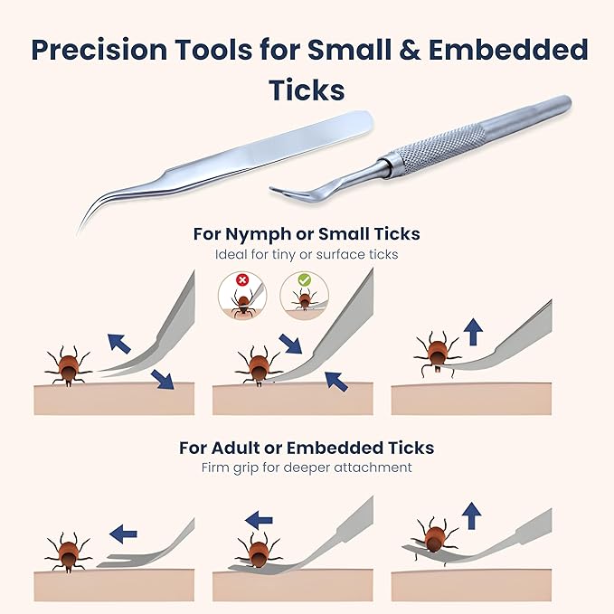 Complete Tick Removal Kit for Dogs & Cats – Tick Remover Tool Set with 3 Size Hooks, Tick Comb & Stainless Steel Precision Tick Remover + Tweezers, Travel Pouch – Safe, Fast Tick Removal