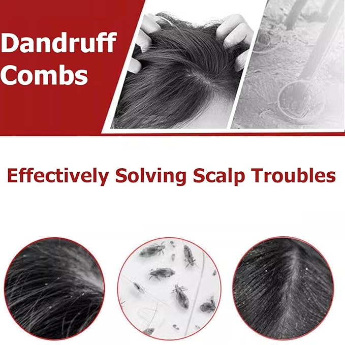 Multifunctional Dandruff Comb, Stainless Steel Fine Tooth Comb Dandruff Remover for Kids Adults Pets Dog